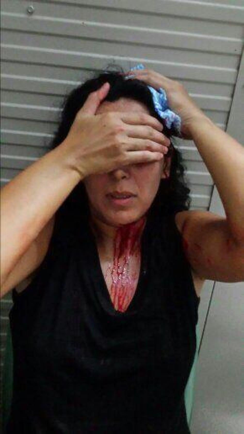 2016-08-crd-nauru-violence